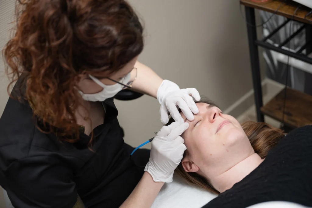 Epilation définitive électrolyse thermolyse Agen